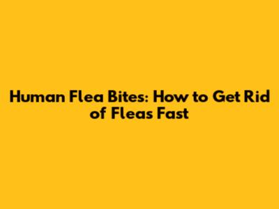 Human Flea Bites: How to Get Rid of Fleas Fast